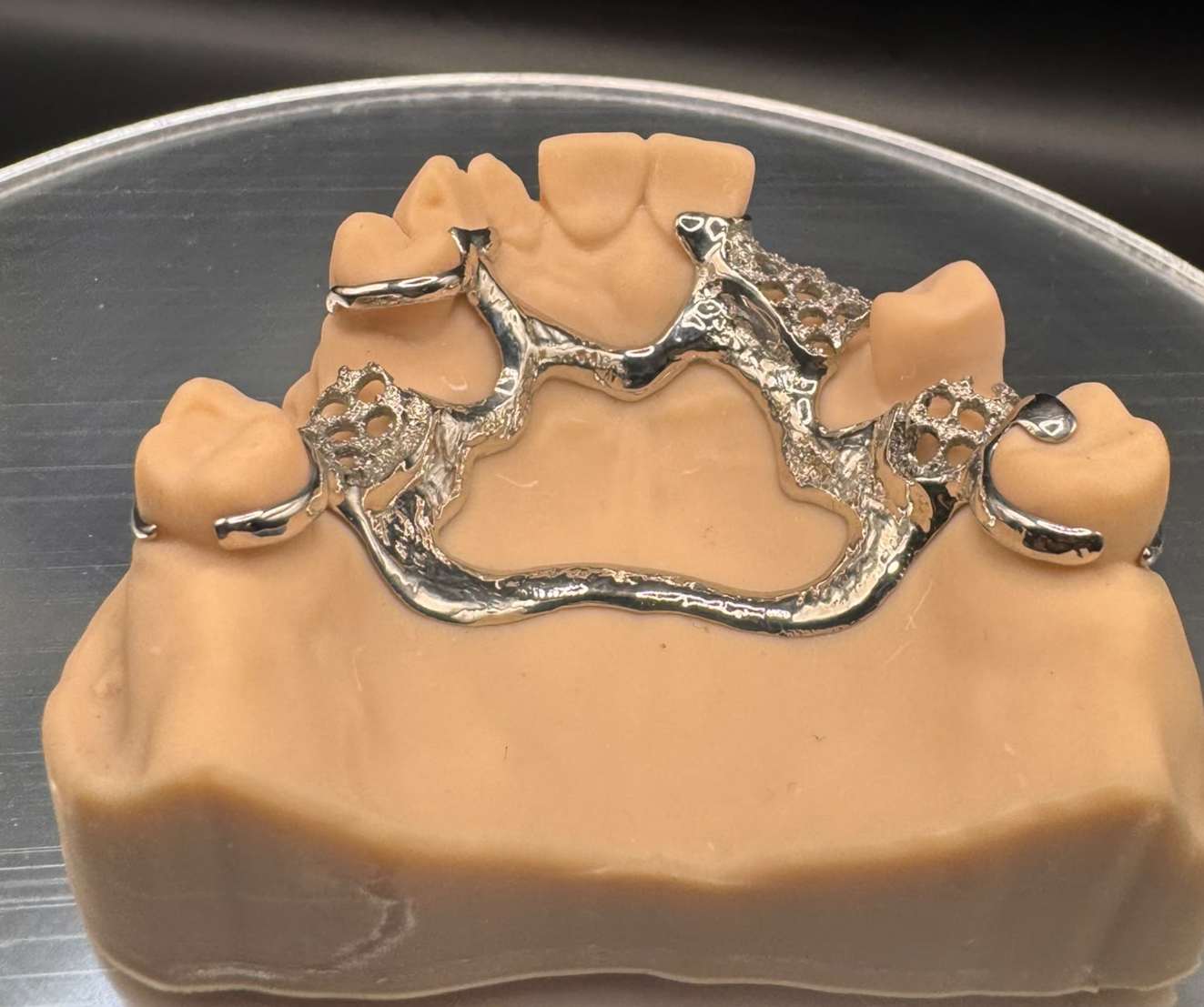 Front view of a metal partial denture framework seated on a dental model