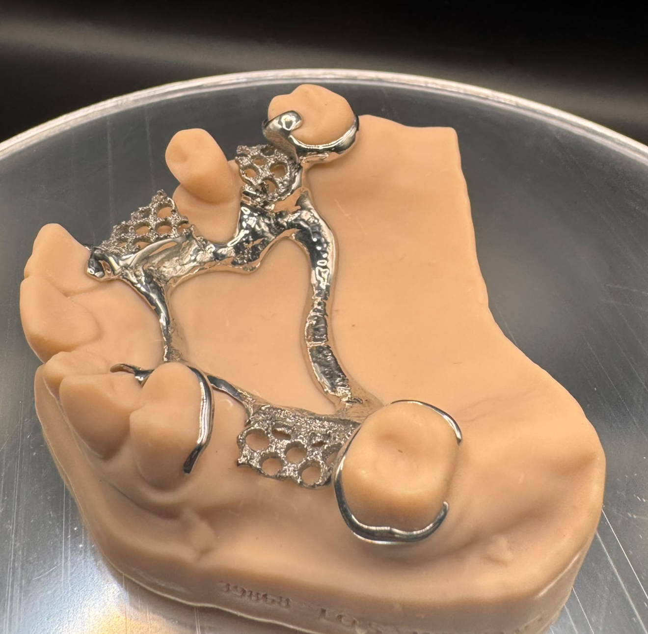 Side view showing the connector and clasps of a metal partial denture framework