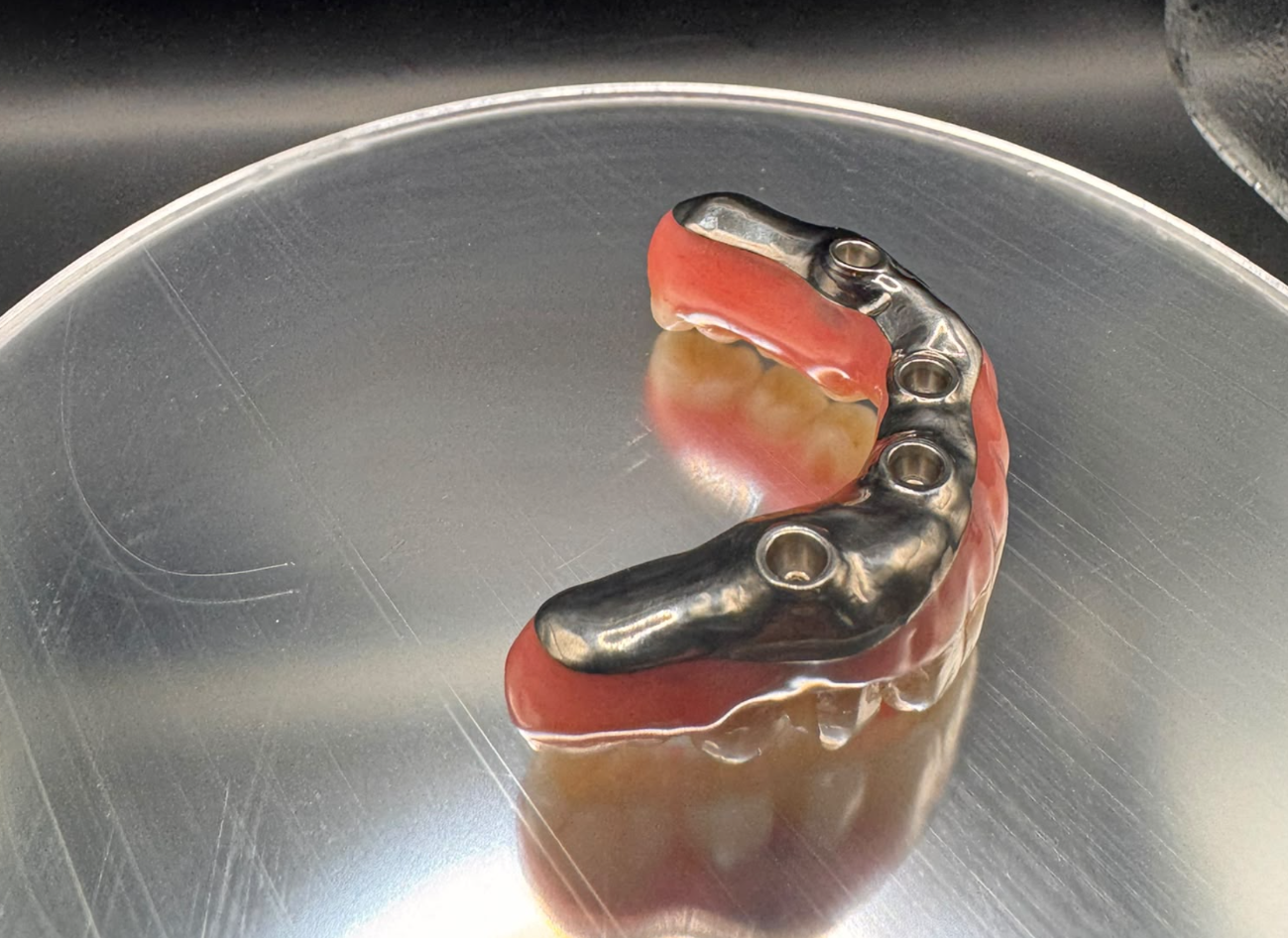 Underside of a full-arch restoration showing its metal substructure and implant connection openings