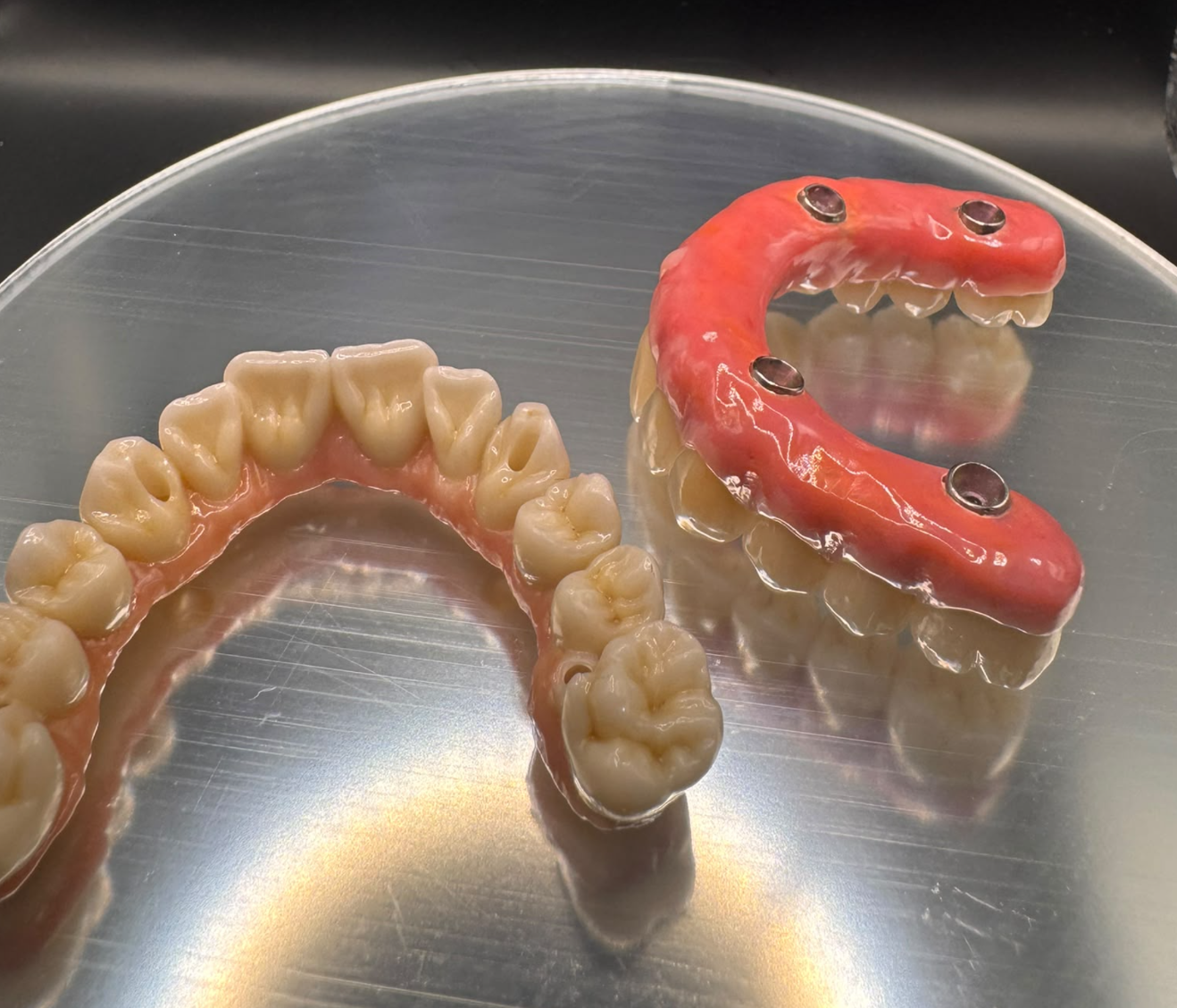 Two full-arch restorations showing the tooth surfaces and underside implant connection openings
