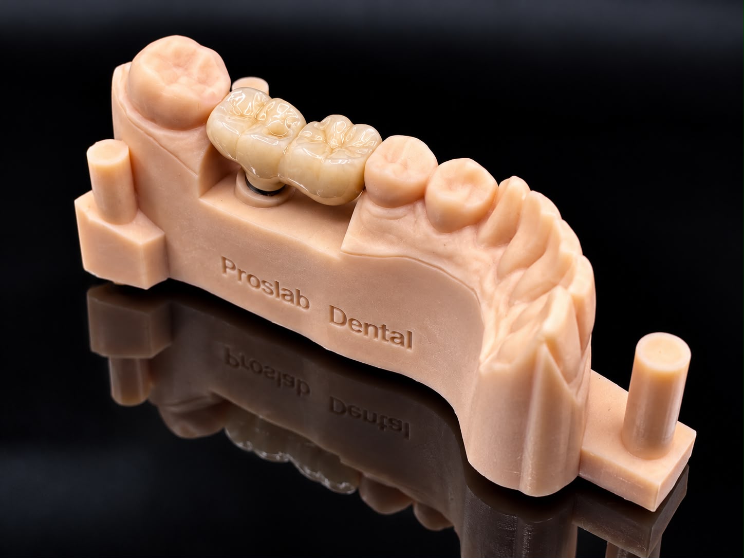 Tooth-coloured bridge seated on a Proslab dental model, viewed from above