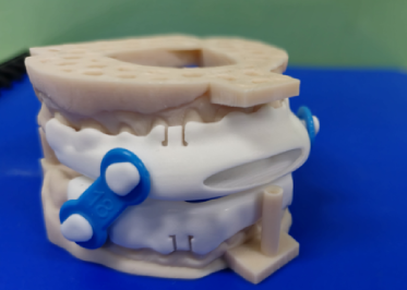 Nylon iFlo-Plus appliance, from the Dental Sleep Lab catalogue